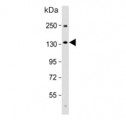 Western blot analysis of BMPR2 antibody and human heart tissue lysate. Predicted molecular weight ~115 kDa (precursor).