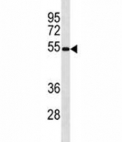 Ips-1 antibody western blot analysis in mouse spleen tissue lysate. Predicted molecular weight: 51-54 kDa (cleaved), 57 kDa (unmodified), 75 kDa (aggregated).
