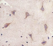 IHC analysis of FFPE human brain section using TSC2 antibody; Ab was diluted at 1:25.