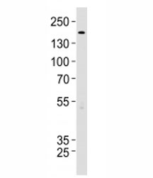 TSC2 antibody western blot analysis in 293 lysate. Predicted molecular weight ~200 kDa.~