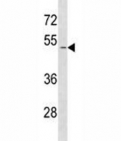 SMAD1 antibody western blot analysis in HeLa lysate. Predicted molecular weight: 52~60 kDa.