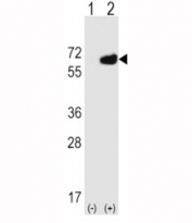 Western blot analysis of NT5E/ CD73 antibody and 293 cell lysate (2 ug/lane) either nontransfected (Lane 1) or transiently transfected (2) with the NT5E gene.