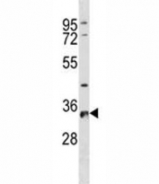 RPS6 antibody western blot analysis in A431 lysate. Predicted molecular weight ~29 kDa.