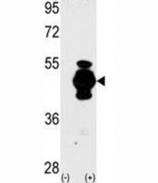 Western blot analysis of GFAP antibody and 293 cell lysate (2 ug/lane) either nontransfected (Lane 1) or transiently transfected with the GFAP gene (2).