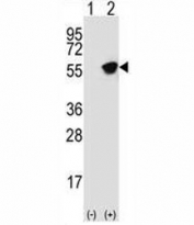 Western blot analysis of Glial fibrillary acidic protein antibody and 293 cell lysate (2 ug/lane) either nontransfected (Lane 1) or transiently transfected (2) with the GFAP gene.