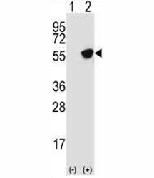 Western blot analysis of Glial fibrillary acidic protein antibody and 293 cell lysate (2 ug/lane) either nontransfected (Lane 1)