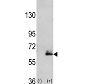 Western blot analysis of anti-MAP2 antibody and 293 cell lysate (2 ug/lane) either nontransfected (Lane 1) or transiently transfected with the hMAP2-Q425 gene (2).~