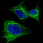 Fluorescent confocal image of SY5Y cells stained with Nestin antibody at 1:200. Note the highly specific localization of the Nestin immunosignal to the intermediate filaments.
