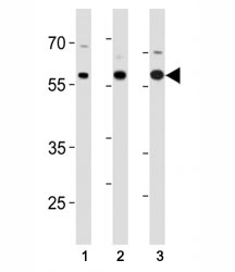 p65 antibody western blot analysis in (1) SK-BR-3, (2) mouse Neuro-2a cell line and (3) mouse testis tissue lysate.