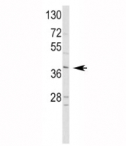 Western blot analysis of NeuroD1 and HepG2 lysate
