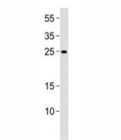 Western blot analysis of lysate from K562 cell line using RAB27A antibody diluted at 1:1000.