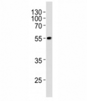 Western blot analysis of lysate from WiDr cell line using PDX1 at 1:1000. Predicted molecular weight ~54kDa.