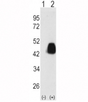 Western blot analysis of PDX1 antibody and 293 cell lysate either nontransfected (Lane 1) or transiently transfected with the PDX1 gene (2).