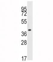 Western blot analysis of PDX1 antibody and NCI-H460 lysate. Predicted molecular weight ~54kDa.