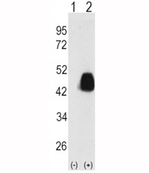 Western blot analysis of PDX1 antibody and 293 cell lysate either nontransfected (Lane 1) or transiently transfected with the PDX1 gene (2).