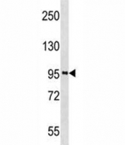 PROX1 antibody western blot analysis in A2058 lysate