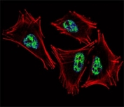Fluorescent confocal image of A2058 cell stained with PROX1 antibody at 1:25. PROX1 immunoreactivity is localized to the nucleus.