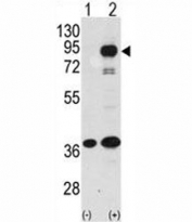 Western blot analysis of PROX1 antibody and 293 cell lysate (2 ug/lane) either nontransfected (Lane 1) or transiently transfected with the human gene (2).