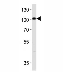 PROX1 antibody western blot analysis in SH-SY5Y lysate. Predicted molecular weight is 83 kDa, observed at 80-110 kDa.