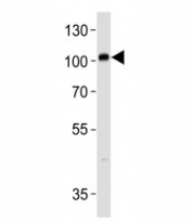 PROX1 antibody western blot analysis in SH-SY5Y lysate. Predicted molecular weight is 83 kDa, observed at 80-110 kDa.
