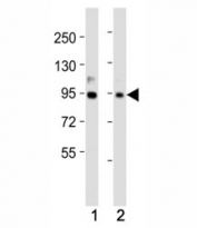 Western blot testing of PROX1 antibody at 1:2000 dilution. Lane 1: SW620 lysate; 2: SH-SY5Y lysate