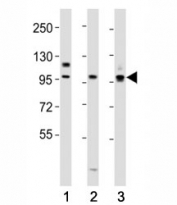 Western blot testing of PROX1 antibody at 1:2000 dilution. Lane 1: HepG2 lysate; 2: mouse liver lysate; 3: SH-SY5Y lysate; Predicted molecular weight is 83 kDa, observed at 80-110 kDa.