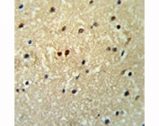 PROX1 antibody IHC analysis in formalin fixed and paraffin embedded human brain tissue.