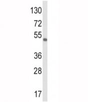 Western blot analysis of VEGF-C antibody and 293 lysate. Predicted molecular weight ~45 kDa.