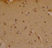 IHC analysis of FFPE human brain stained with SOX4 antibody