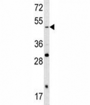 Western blot analysis of SOX4 antibody and A2058 lysate. Expected/observed molecualr weight ~47 kDa.