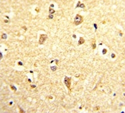 IHC analysis of FFPE human brain stained with SOX4 antibody