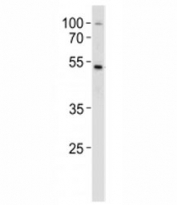 SOX4 antibody western blot analysis in MCF-7 lysate. Expected/observed molecualr weight ~47kDa.