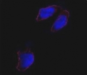 Immunofluorescence analysis of Oct4 antibody and HeLa cells. Primary Ab was followed by Alexa-Fluor-546-conjugated donkey rabbit lgG (H+L). Alexa-Fluor-546 emits orange fluorescence. Blue counterstaining is DAPI.