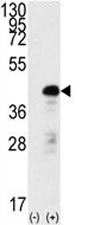 Western blot analysis of SOX2 antibody and 293 cell lysate (2 ug/lane) either nontransfected (Lane 1) or transiently transfected with the SOX2 gene (2).~