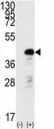 Western blot analysis of SOX2 antibody and 293 cell lysate (2 ug/lane) either nontransfected (Lane 1) or transiently transfected with the SOX2 gene (2).