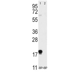 Western blot analysis of Thy1 antibody pre-incubated without (Lane 1) and with (2) blocking peptide in T47D lysate~