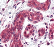 IHC analysis of FFPE human breast tissue stained with SLUG antibody.
