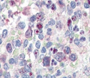 IHC analysis of FFPE human spleen tissue stained with anti-SNAIL antibody