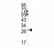 Western blot analysis of SNAI1 antibody and NCI-H460 lysate