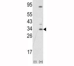 Western blot analysis of SNAI1 antibody and 293 cell lysate (2 ug/lane) either nontransfected (Lane 1) or transiently transfected with the SNAIL gene (2).~