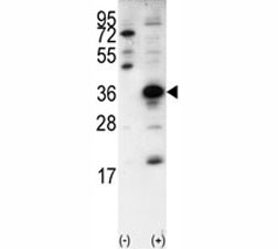 Western blot analysis of SNAI1 antibody and 293 cell lysate (2 ug/lane) either nontransfected (Lane 1) or transiently transfected with the SNAI1 gene (2).