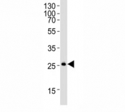 Western blot analysis of mouse kidney lysate using SNAI1 antibody at 1:1000.