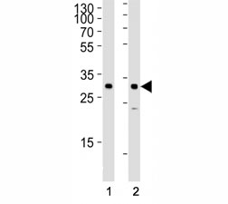 Western blot analysis of lysate from (1) HeLa and (2) SiHa cell line using SNAI1 antibody at 1:1000. Predicted size 29 kDa~