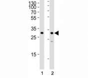 Western blot analysis of lysate from (1) HeLa and (2) SiHa cell line using SNAI1 antibody at 1:1000. Predicted molecular weigth ~29kDa.