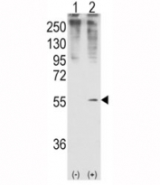 Western blot analysis of GDF11 antibody and 293 cell lysate (2 ug/lane) either nontransfected (Lane 1) or transiently transfected with the GDF11 gene (2).
