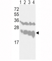 Western blot analysis of PGP9.5 antibody and CEM (lane 1), Jurkat (2), Y79 (3) cell lines and mouse brain tissue (4) lysate. Predicted molecular weight ~25 kDa.