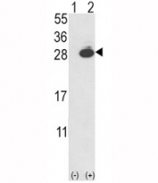 Western blot analysis of PGP9.5 antibody and 293 cell lysate (2 ug/lane) either nontransfected (Lane 1) or transiently transfected with the UCHL1 gene (2).