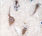 IHC analysis of FFPE human brain tissue stained with PGP9.5 antibody.