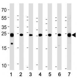 PGP9.5 antibody western blot analysis with (1) U266, (2) SH-SY5Y, (3) NCI-H1299, (4) mouse Neuro-2a, (5) rat C6, (6) PC-12 cell line and (7) mouse brain tissue lysate. Predicted molecular weight ~25 kDa.