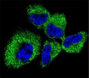 Confocal immunofluorescent analysis of PGP9.5 antibody with NCI-H460 cells followed by Alexa Fluor 488-conjugated goat anti-rabbit lgG (green). DAPI was used as a nuclear counterstain (blue).
